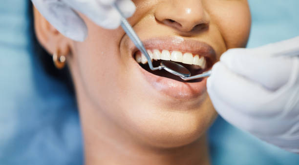 Best Emergency Tooth Extraction in Wells Branch, TX