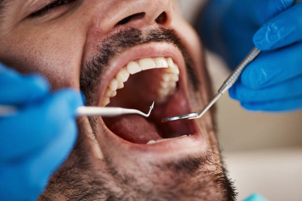 Best Emergency Treatment for Dental Infections or Abscesses in Wells Branch, TX